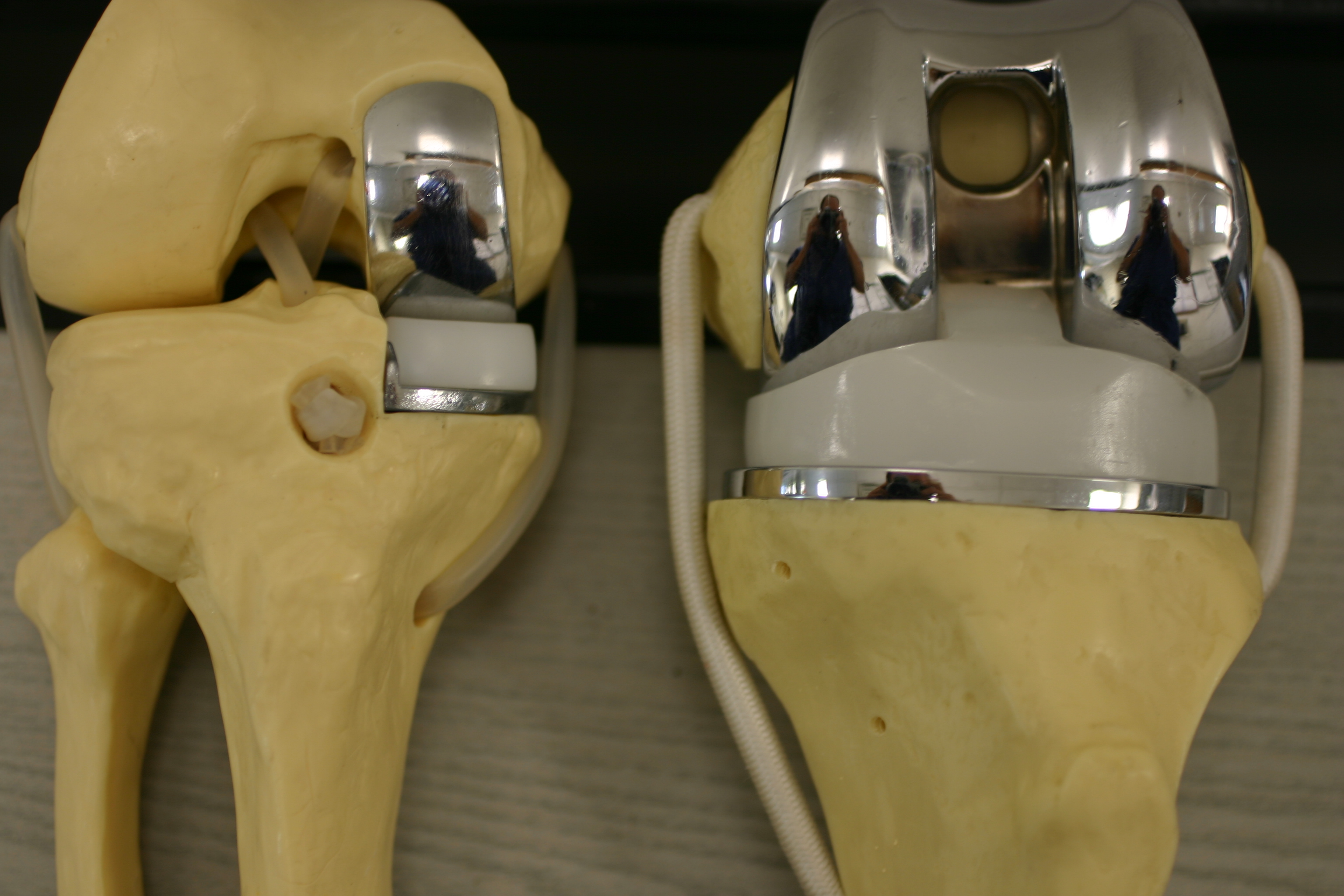 arthroscopy image